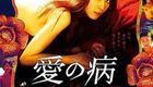 爱之病